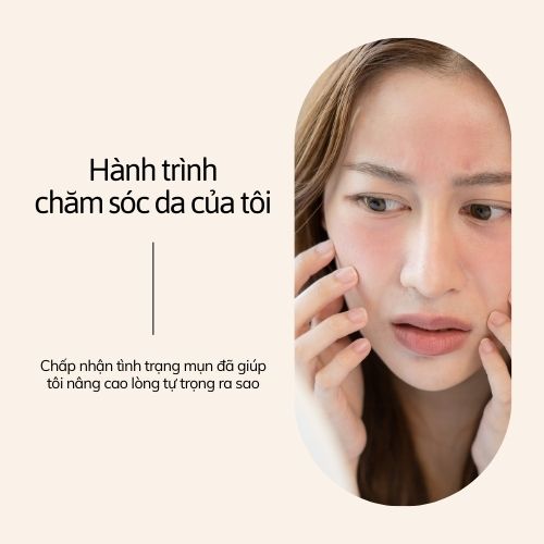 Điều trị mụn - nám - tàn nhang