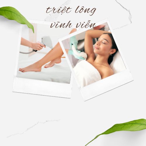 Triệt lông vĩnh viễn